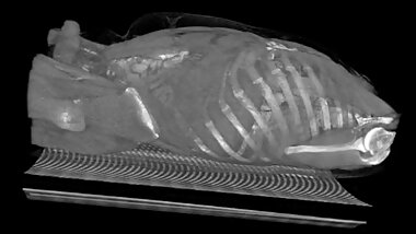 Told you my cock was too small..you be the judge. see it in Virtual 3d CT!