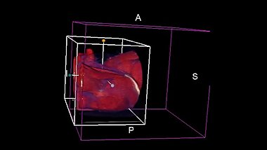 Told you my cock was too small - colorized 3d CT Scan - pelvis only