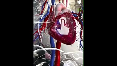 3D heart