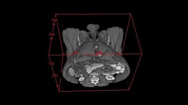 Told you my cock was too small... 3d CT Scan - pelvis only view